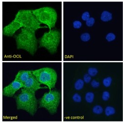 C-Type Lectin Domain Family 2 Member D5 (CLEC2D) Antibody