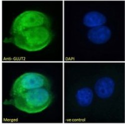 Glucose Transporter 2 / GLUT2 (SLC2A2) Antibody