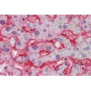 IHC-P analysis of Human liver tissue, using Glucose Transporter 2 / GLUT2 (SLC2A2) Antibody (2.5 µg/ml).