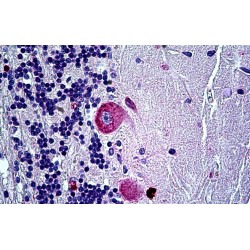 Ephrin A5 (EFNA5) Antibody