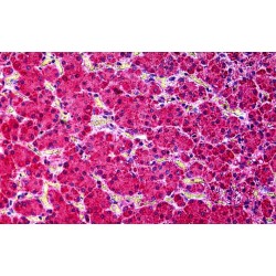 Intermediate Conductance Calcium-Activated Potassium Channel Protein 4 (KCNN4) Antibody