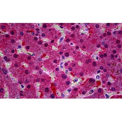 Intermediate Conductance Calcium-Activated Potassium Channel Protein 4 (KCNN4) Antibody