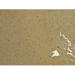 Chloride Channel Protein 2 (CLCN2) Antibody