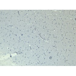 Chloride Channel Protein 2 (CLCN2) Antibody