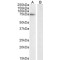 Cytochrome B-245 Heavy Chain (CYBB) Antibody