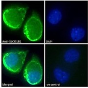 IF analysis of HEPG2 cells, using Solute Carrier Organic Anion Transporter Family Member 1B1 (SLCO1B1) Antibody (10 µg/ml) followed by AF488 secondary antibody (2 µg/ml) showing plasma membrane staining. The nuclear stain is DAPI (blue). Negative control: Unimmunized goat IgG (10 µg/ml) followed by AF488 secondary antibody (2 µg/ml)