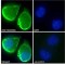 Solute Carrier Organic Anion Transporter Family Member 1B1 (SLCO1B1) Antibody