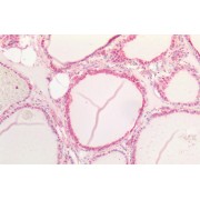 abx433684