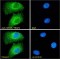 Serine/Threonine-Protein Kinase MTOR (MTOR) Antibody