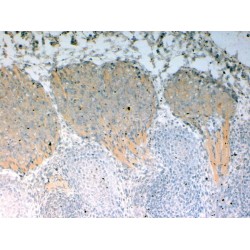 NUMB Like, Endocytic Adaptor Protein (NUMBL) Antibody