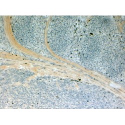 NUMB Like, Endocytic Adaptor Protein (NUMBL) Antibody