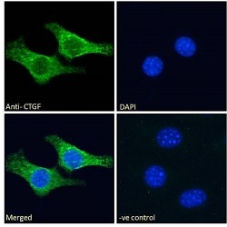 CCN Family Member 2 (CCN2) Antibody