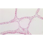 IHC-P analysis of Human thyroid tissue, using CCN Family Member 2 (CCN2) Antibody (5 µg/ml).