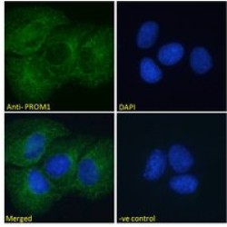 Prominin-1 (PROM1) Antibody