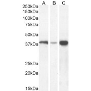 Western blot analysis of Human Liver (A), Duodenum (B) and Breast (C) tissue lysate (35 µg protein in RIPA buffer) using Alcohol Dehydrogenase (pan-ADH) Antibody (0.3 µg/ml).