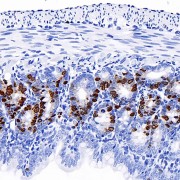 Immunohistochemistry analysis of paraffin-embedded mouse jejunum(intraperitoneal injection BrdU every 2 hours for 4 times) using Brdu Monoclonal Antibody (1/300 dilution).