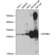 Western blot analysis of extracts of various cell lines using CRYBB2 Antibody (1/1000 dilution).