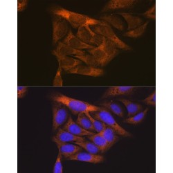 Vascular Endothelial Growth Factor Receptor 1 (FLT1) Antibody