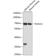 Western blot analysis of extracts of various cell lines using Perforin Antibody (1/1000 dilution).