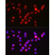 Immunofluorescence analysis of Jurkat cells using BCL2A1 Antibody (1/250 dilution, 40x lens). Blue: DAPI for nuclear staining.