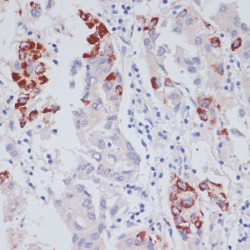 Vasodilator-Stimulated Phosphoprotein (VASP) Antibody