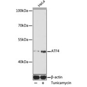 Western blot analysis of extracts of HeLa cells using ATF4 Antibody (1/1000 dilution).HeLa cells were treated by tunicamycin (2 μg/mL) for 8 hours.