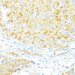 Bcl2 Associated X Protein (BAX) Antibody