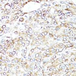 Bcl2 Associated X Protein (BAX) Antibody