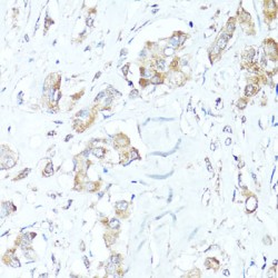 Bcl2 Associated X Protein (BAX) Antibody