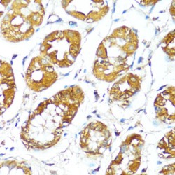 Bcl2 Associated X Protein (BAX) Antibody