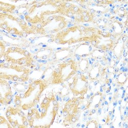 Bcl2 Associated X Protein (BAX) Antibody