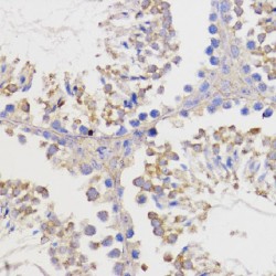 Apoptosis Regulator Bcl-2 (BCL2) Antibody