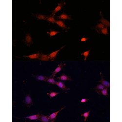 Apoptosis Regulator Bcl-2 (BCL2) Antibody