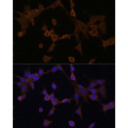 BH3-Interacting Domain Death Agonist (BID) Antibody