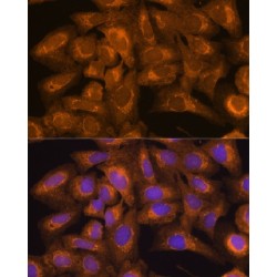 BH3-Interacting Domain Death Agonist (BID) Antibody
