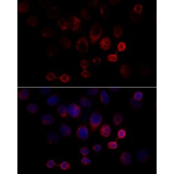 Caspase 3 (CASP3) Antibody