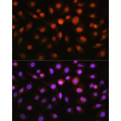 DNA Damage Inducible Transcript 3 (DDIT3) Antibody