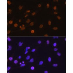 DNA Damage Inducible Transcript 3 (DDIT3) Antibody