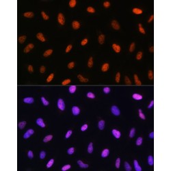 DNA Damage Inducible Transcript 3 (DDIT3) Antibody
