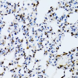 Mitogen-Activated Protein Kinase 3 / ERK1 (MAPK3) Antibody