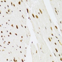Mitogen-Activated Protein Kinase 3 / ERK1 (MAPK3) Antibody