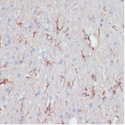 Immunohistochemistry of paraffin-embedded Rat brain using GFAP Antibody (1/200 dilution, 40x lens).