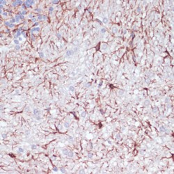 Glial Fibrillary Acidic Protein (GFAP) Antibody