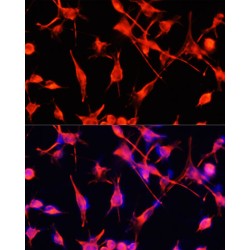 Glial Fibrillary Acidic Protein (GFAP) Antibody