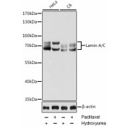 Western blot analysis of extracts of various cell lines using Lamin A/C Antibody (1/1000 dilution). HeLa cells were treated by Hydroxyurea (4 mM) at 37°C for 20 hours or treated by Paclitaxel (100 nM/ml) at 37°C for 20 hours. C6 cells were treated by Hydroxyurea (4 mM) at 37°C for 20 hours or treated by Paclitaxel (100 nM) at 37°C for 20 hours.