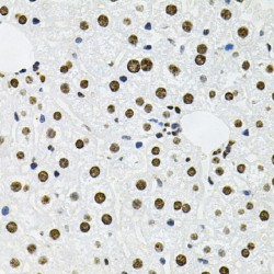 Induced Myeloid Leukemia Cell Differentiation Protein (MCL1) Antibody