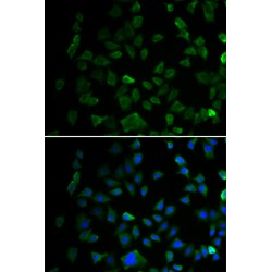 Mitogen Activated Protein Kinase Kinase 1 (MAP2K1) Antibody