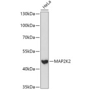 Western blot analysis of extracts of HeLa cells using MAP2K2 Antibody (1/1000 dilution).