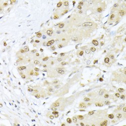 Proliferating Cell Nuclear Antigen (PCNA) Antibody