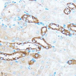 Phosphatidylinositol-4,5-Bisphosphate 3-Kinase Catalytic Subunit Alpha Isoform (PIK3CA) Antibody